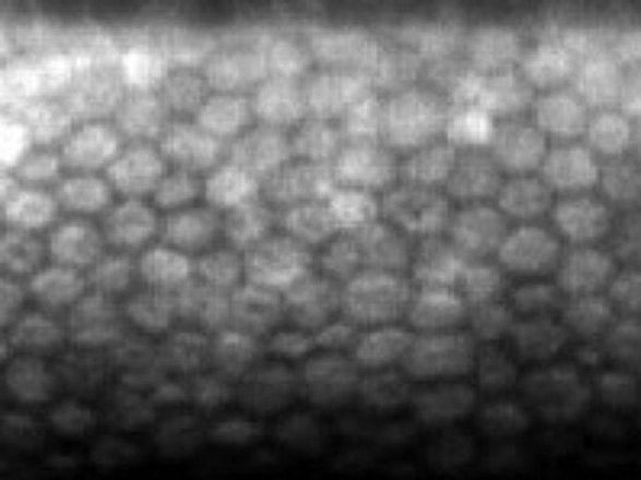 正常な角膜内皮細胞